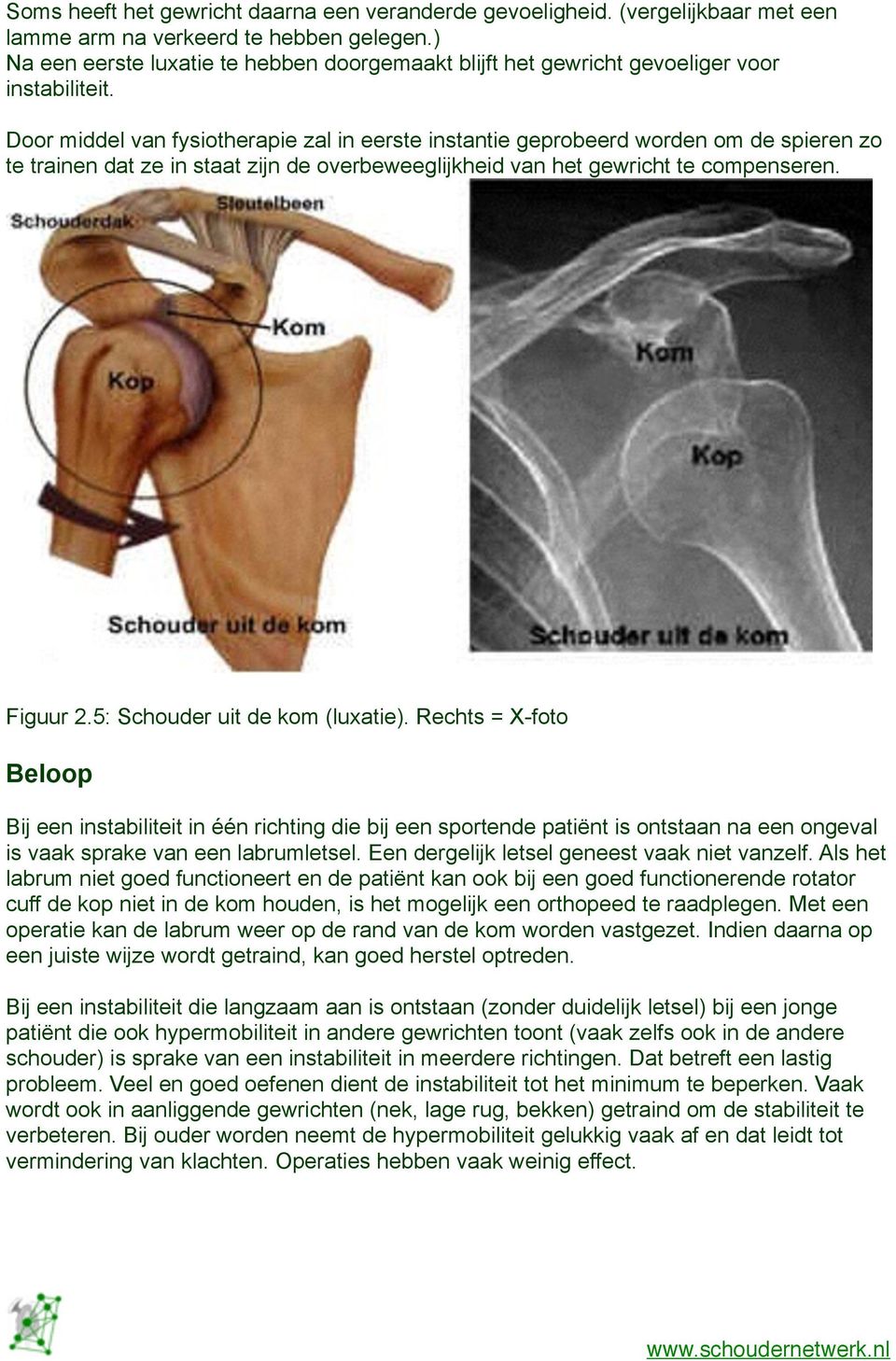 Door middel van fysiotherapie zal in eerste instantie geprobeerd worden om de spieren zo te trainen dat ze in staat zijn de overbeweeglijkheid van het gewricht te compenseren. Figuur 2.