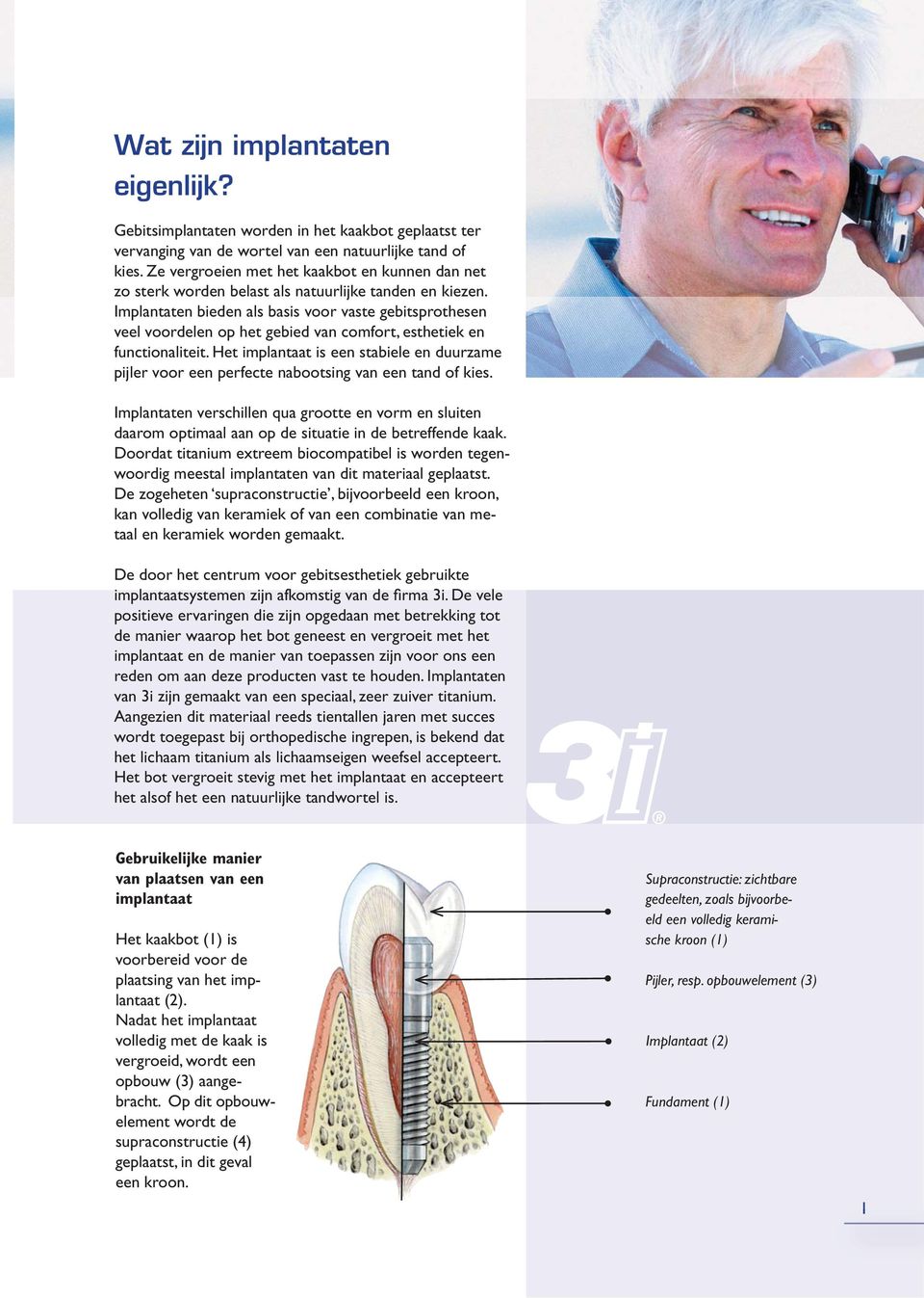 Implantaten bieden als basis voor vaste gebitsprothesen veel voordelen op het gebied van comfort, esthetiek en functionaliteit.