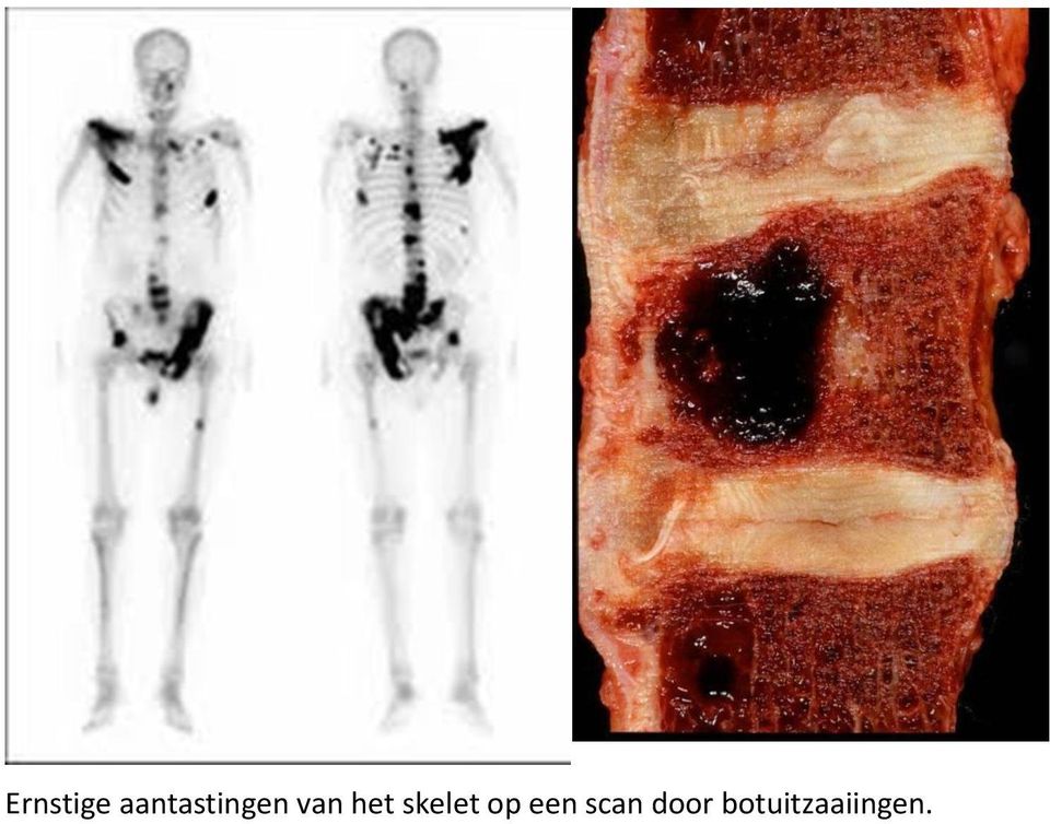 het skelet op een