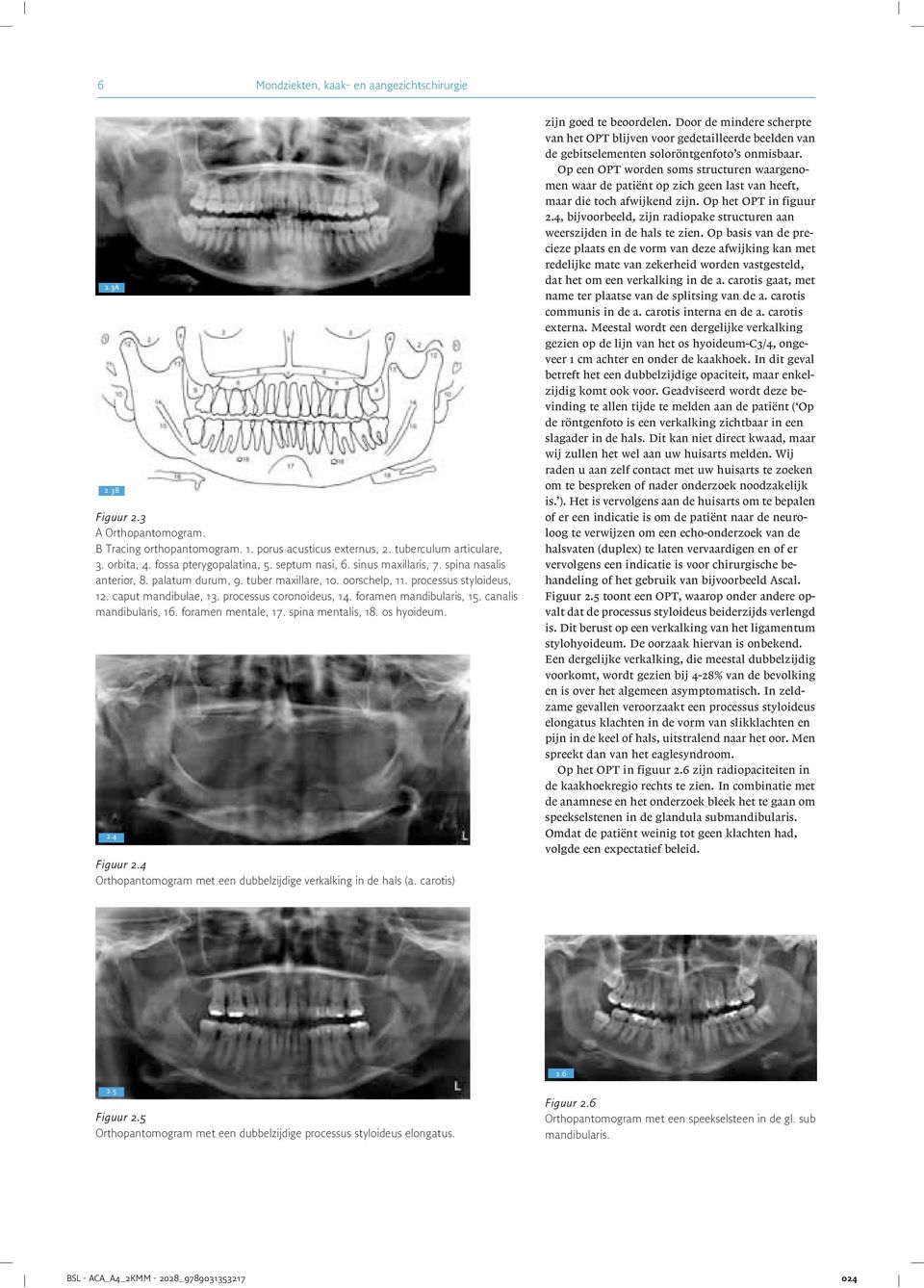 processus coronoideus, 14. foramen mandibularis, 15. canalis mandibularis, 16. foramen mentale, 17. spina mentalis, 18. os hyoideum. j 2:4 Figuur 2.