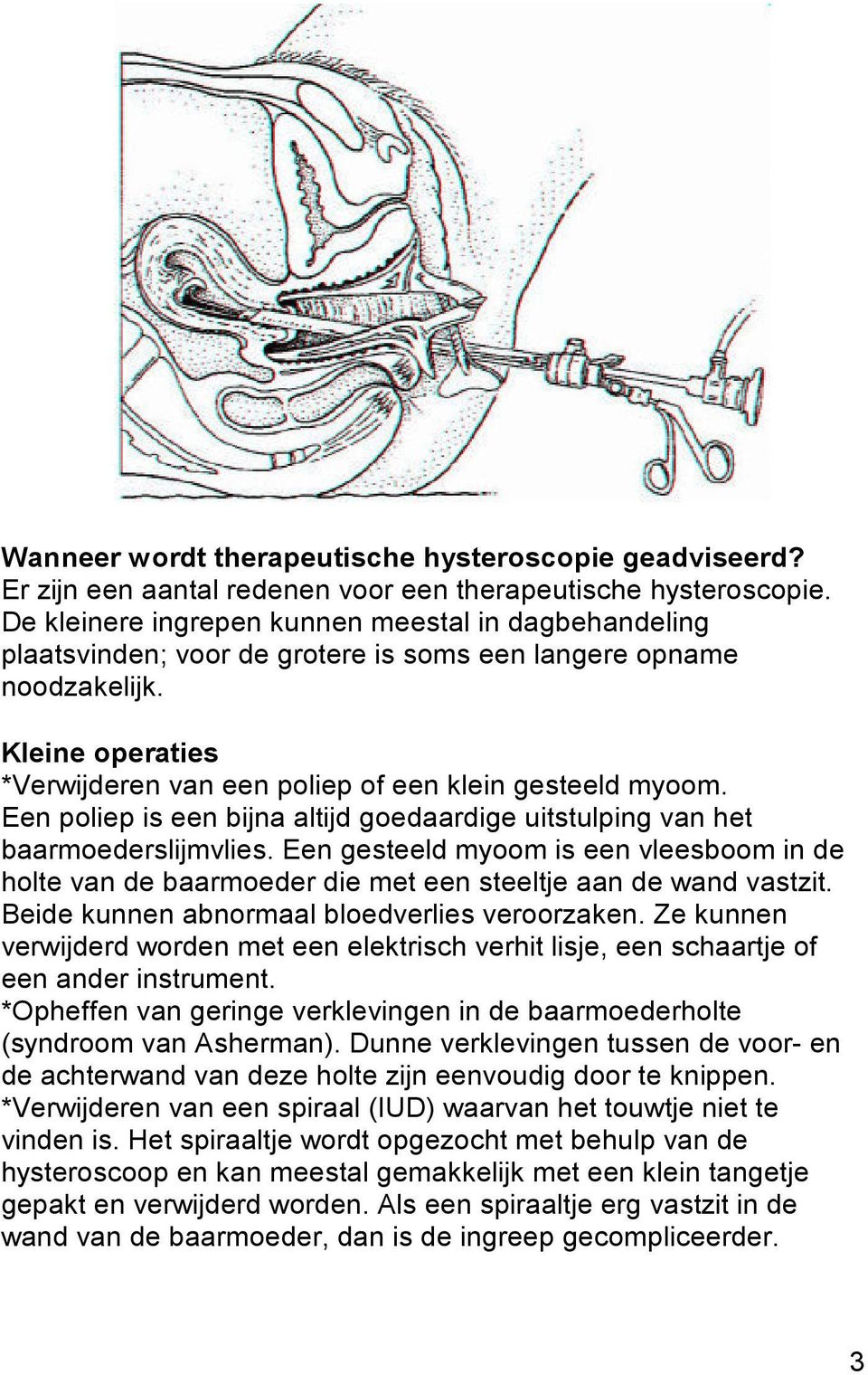 Een poliep is een bijna altijd goedaardige uitstulping van het baarmoederslijmvlies. Een gesteeld myoom is een vleesboom in de holte van de baarmoeder die met een steeltje aan de wand vastzit.