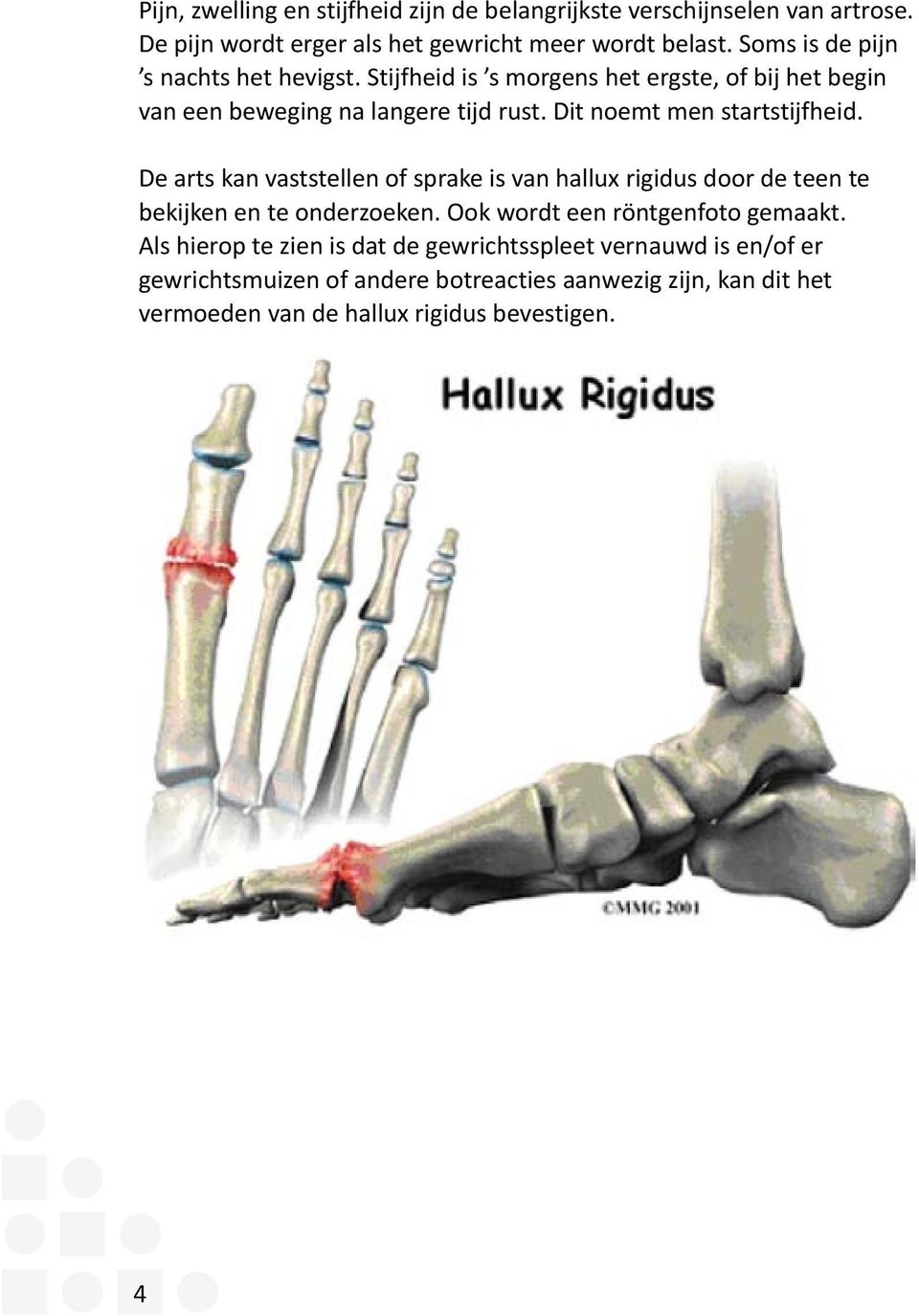 Dit noemt men startstijfheid. De arts kan vaststellen of sprake is van hallux rigidus door de teen te be kijken en te onderzoeken.