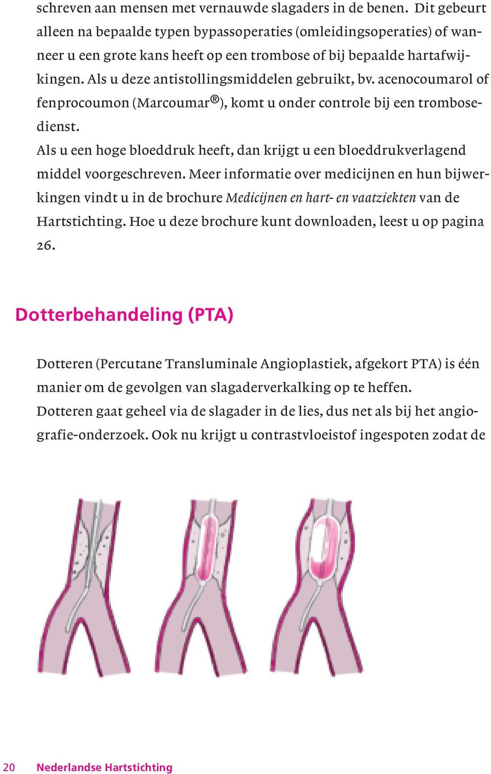 Als u deze antistollingsmiddelen gebruikt, bv. acenocoumarol of fenprocoumon (Marcoumar ), komt u onder controle bij een trombosedienst.