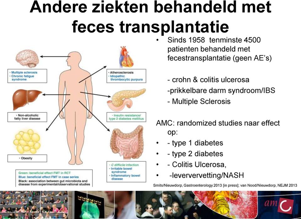 Sclerosis AMC: randomized studies naar effect op: - type 1 diabetes - type 2 diabetes - Colitis