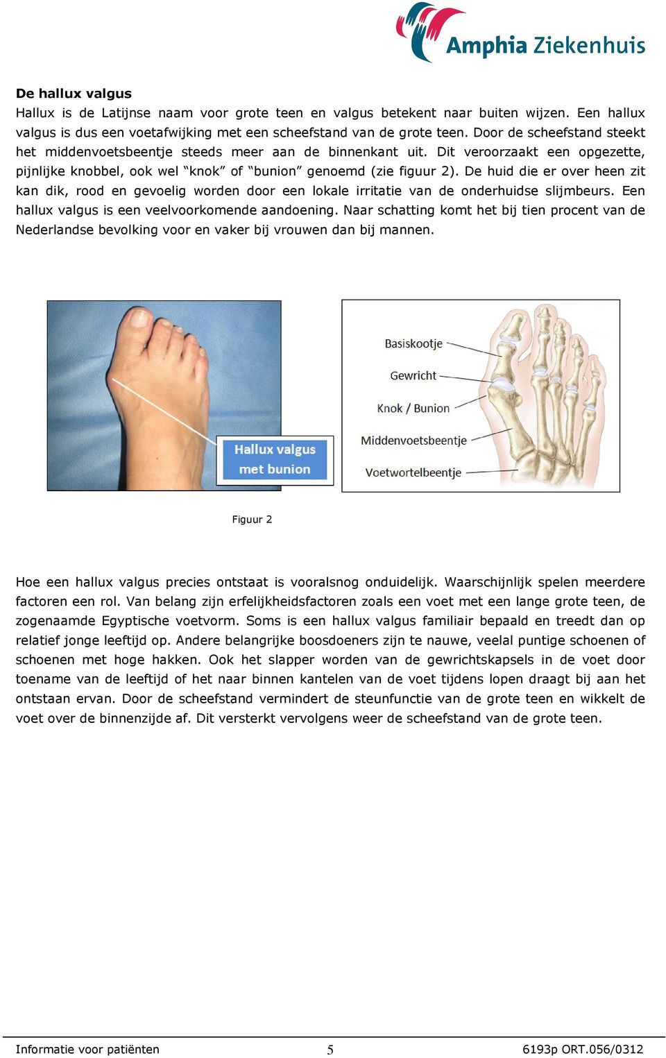 De huid die er over heen zit kan dik, rood en gevoelig worden door een lokale irritatie van de onderhuidse slijmbeurs. Een hallux valgus is een veelvoorkomende aandoening.