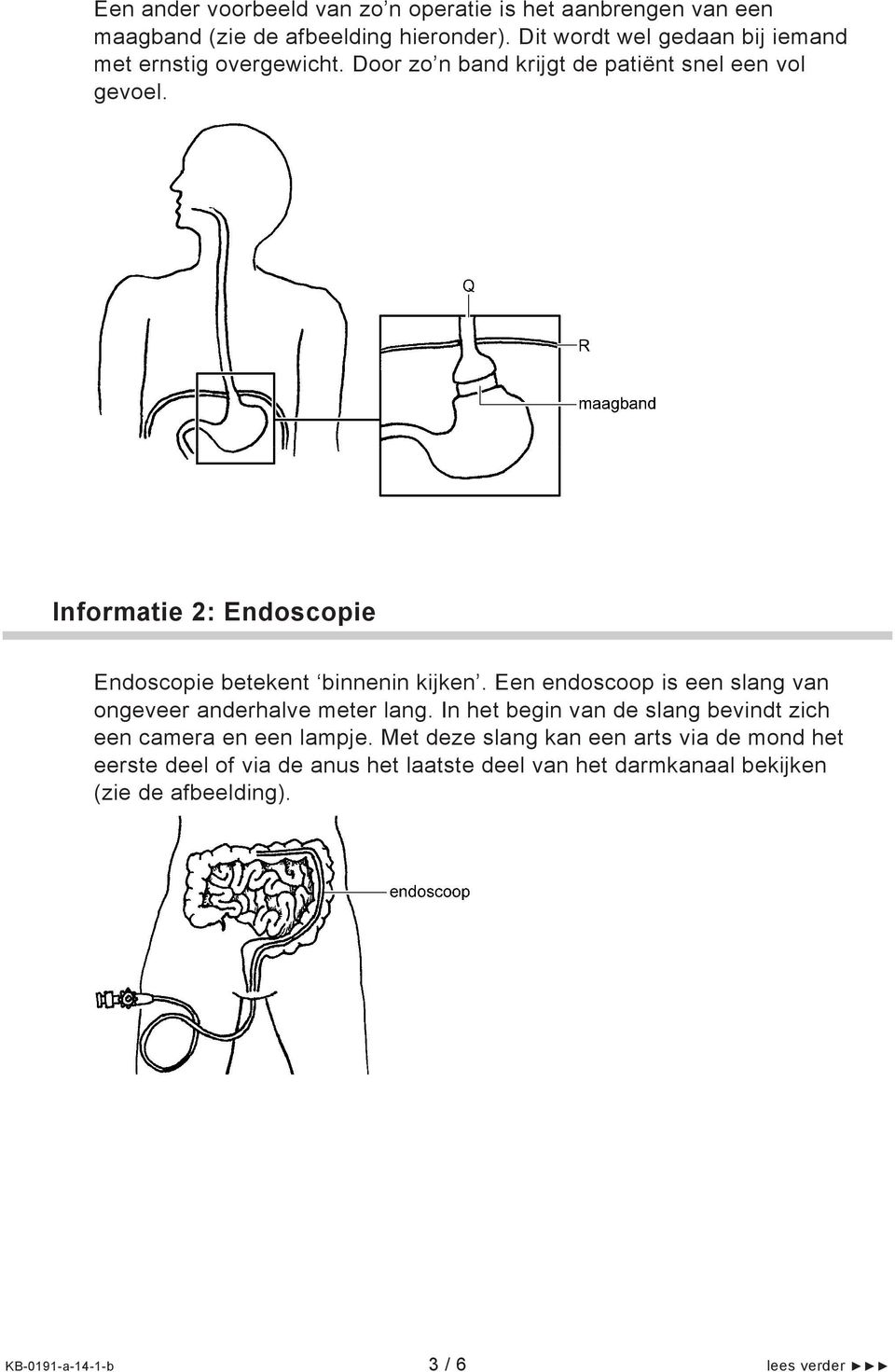 Informatie 2: Endoscopie Endoscopie betekent binnenin kijken. Een endoscoop is een slang van ongeveer anderhalve meter lang.