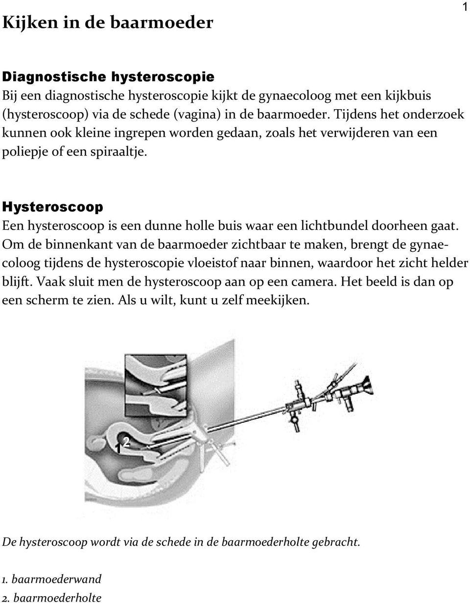 Hysteroscoop Een hysteroscoop is een dunne holle buis waar een lichtbundel doorheen gaat.