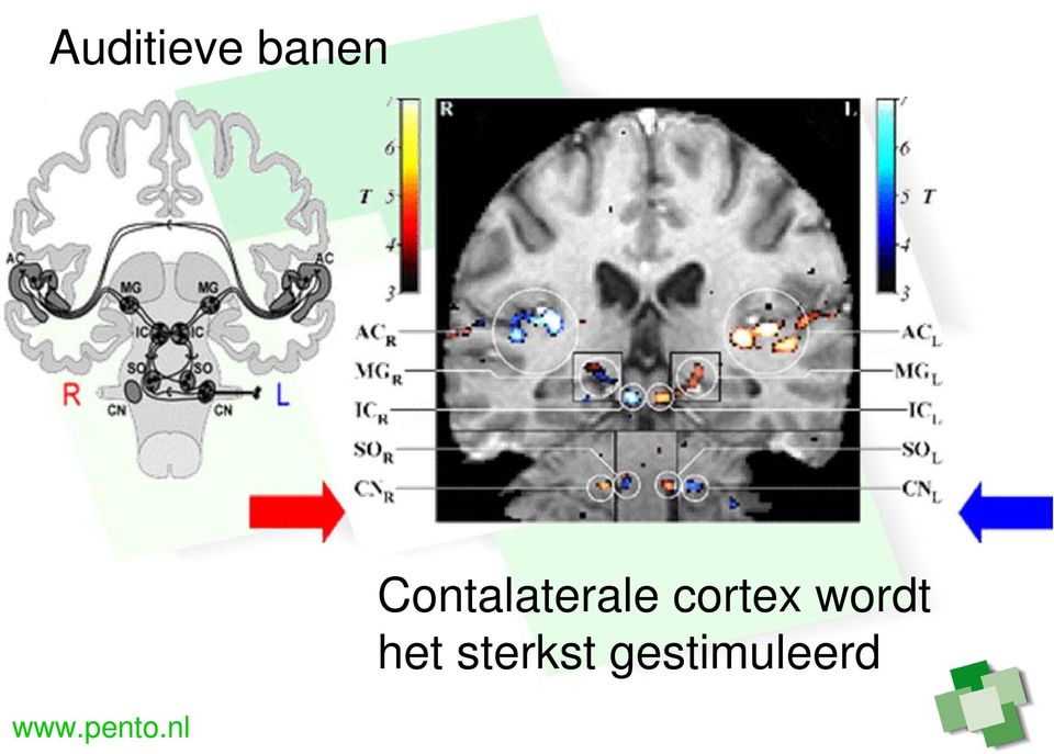 cortex wordt het