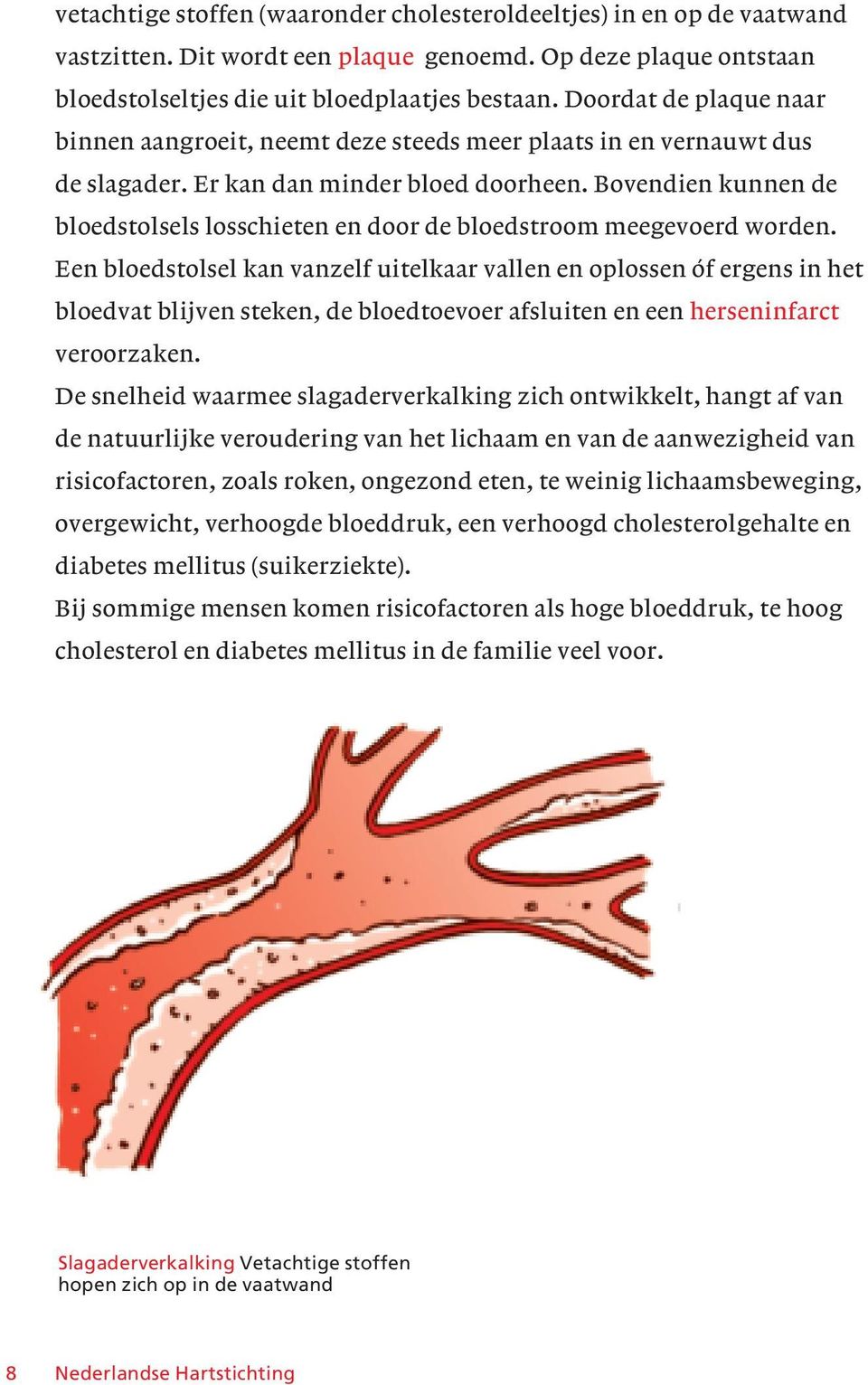 Bovendien kunnen de bloedstolsels losschieten en door de bloedstroom meegevoerd worden.