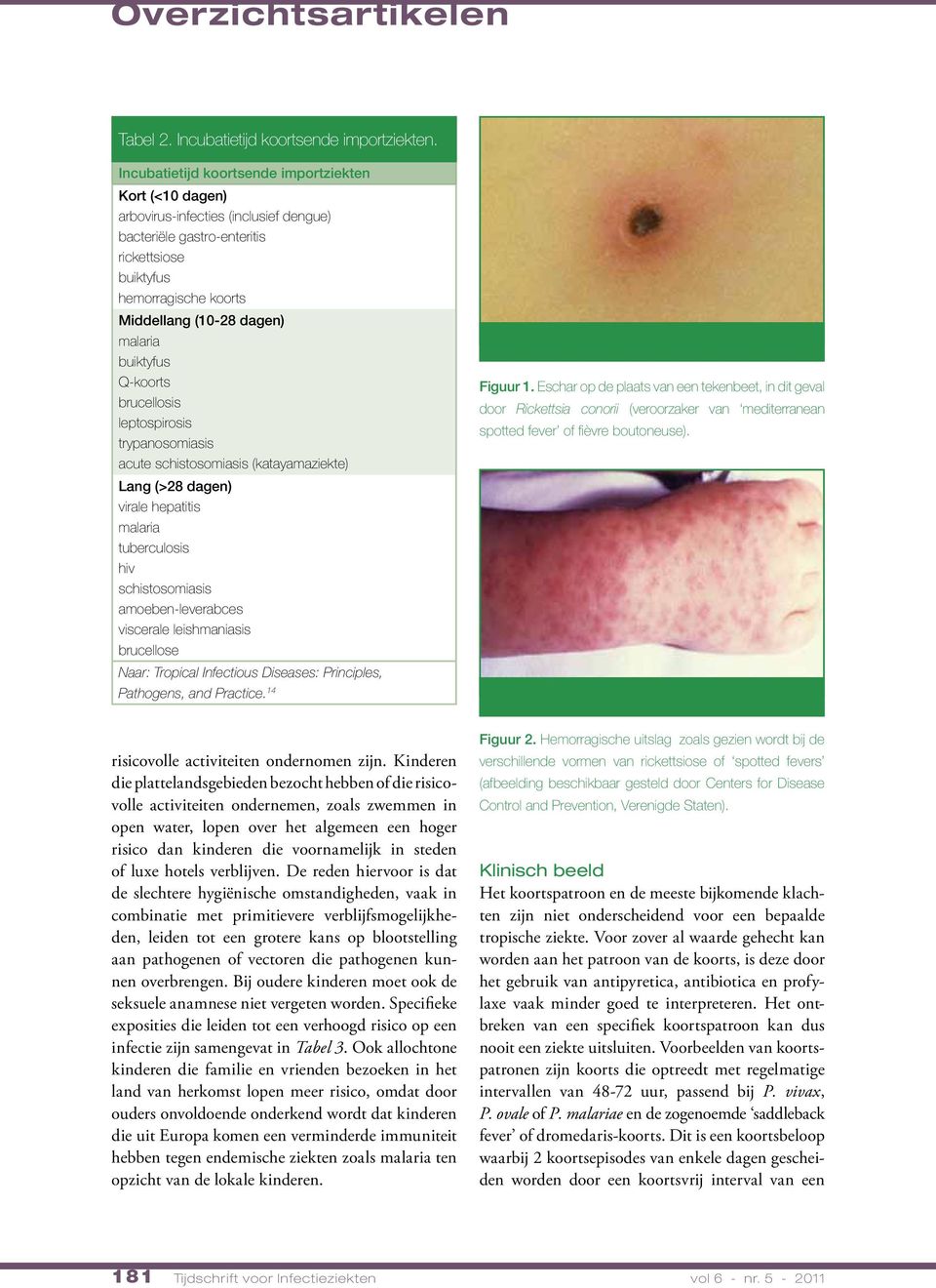 buiktyfus Q-koorts brucellosis leptospirosis trypanosomiasis acute schistosomiasis (katayamaziekte) Lang (>28 dagen) virale hepatitis malaria tuberculosis hiv schistosomiasis amoeben-leverabces