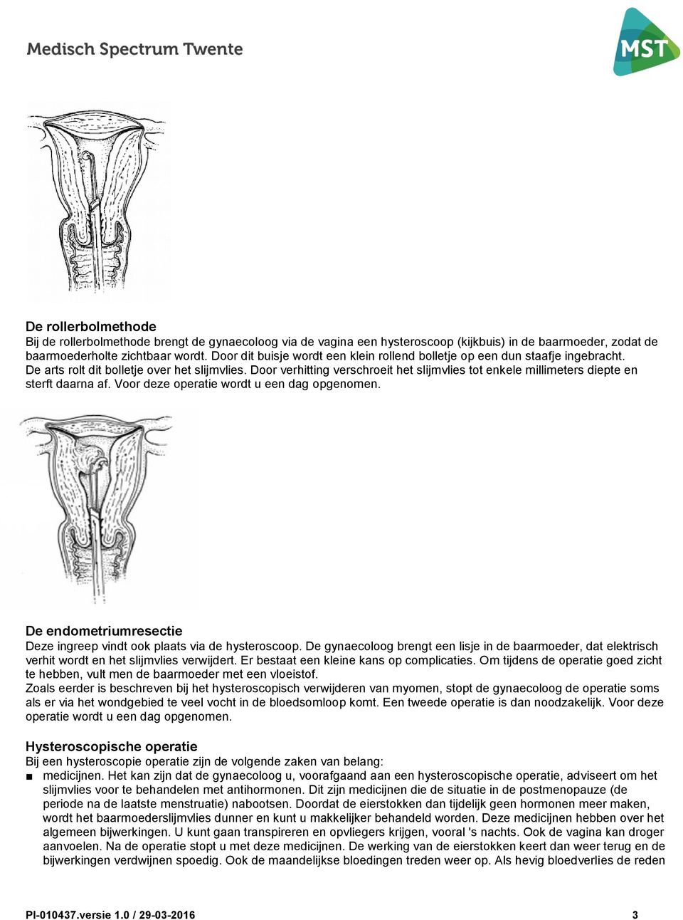 Door verhitting verschroeit het slijmvlies tot enkele millimeters diepte en sterft daarna af. Voor deze operatie wordt u een dag opgenomen.