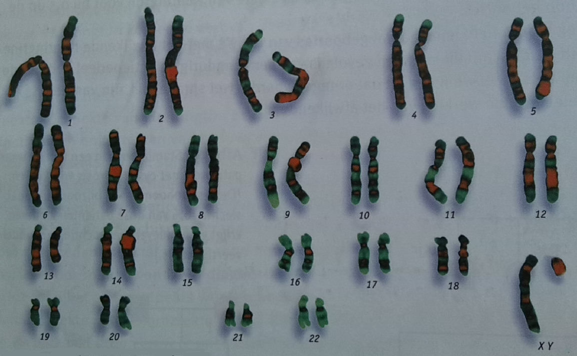 Thema 4 Genetica Basisstof 5 Geslachtschromosomen Karyotype = karyogram = chromosomenportret = de rangschikking van chromosomen in paren van een eukaryote cel van groot naar klein.