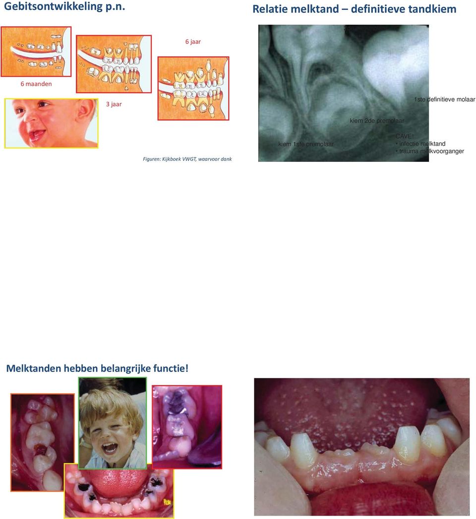 p.n. Relatie melktand definitieve tandkiem 2de melkmolaar 6 jaar 6