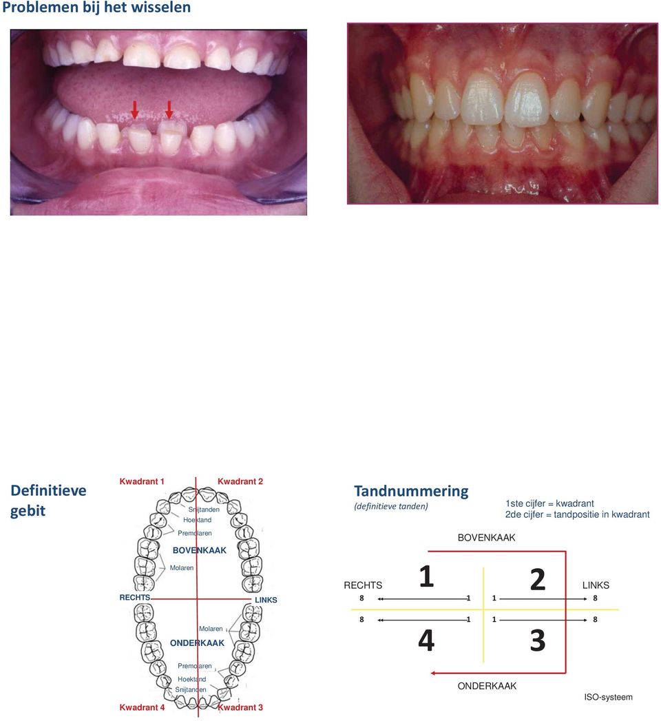 Kwadrant 4 Kwadrant 3 Tandnummering (definitieve tanden) RECHTS 8 1 8 1 BOVENKAAK 1 2 4 3