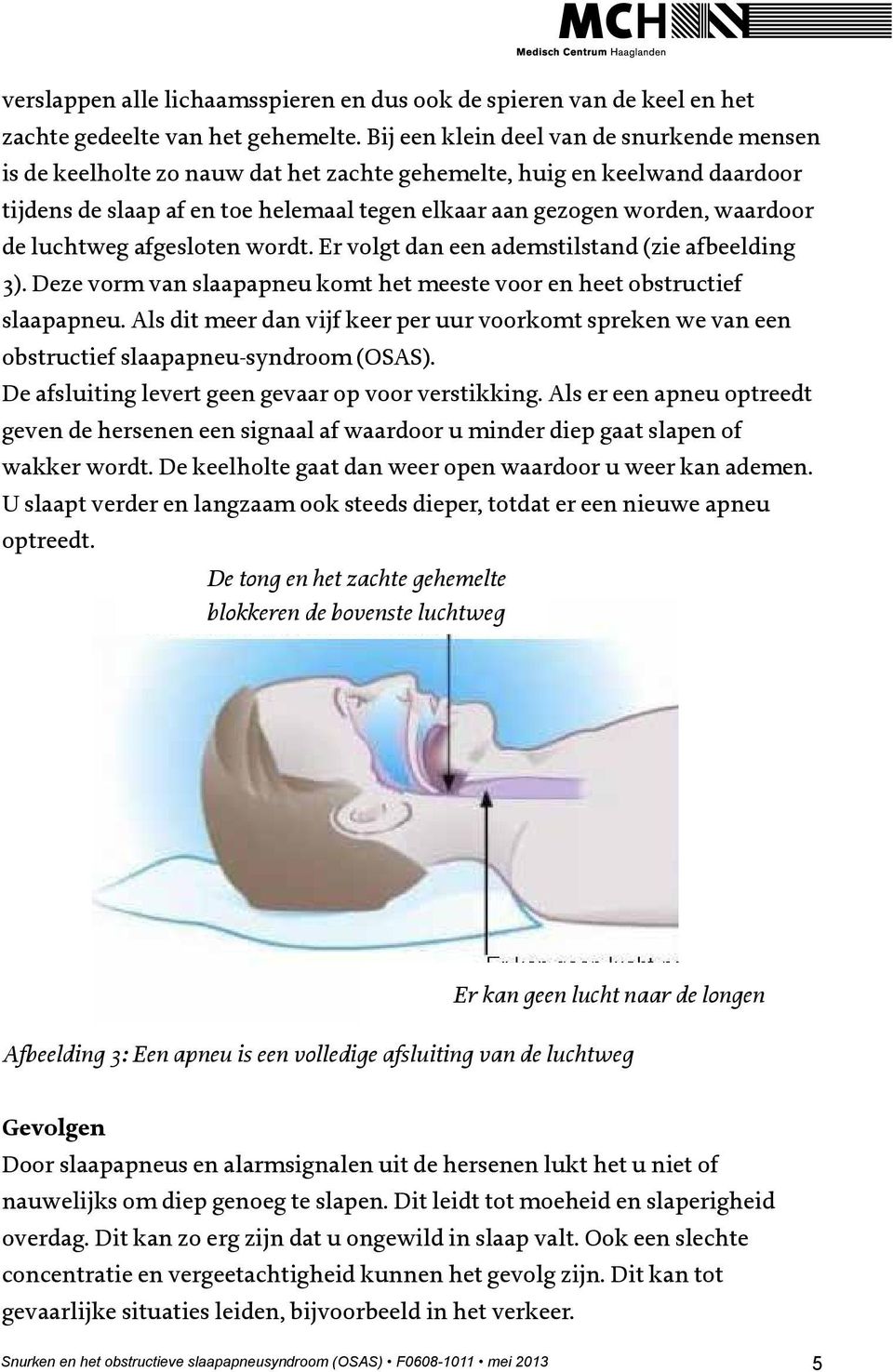 luchtweg afgesloten wordt. Er volgt dan een ademstilstand (zie afbeelding 3). Deze vorm van slaapapneu komt het meeste voor en heet obstructief slaapapneu.