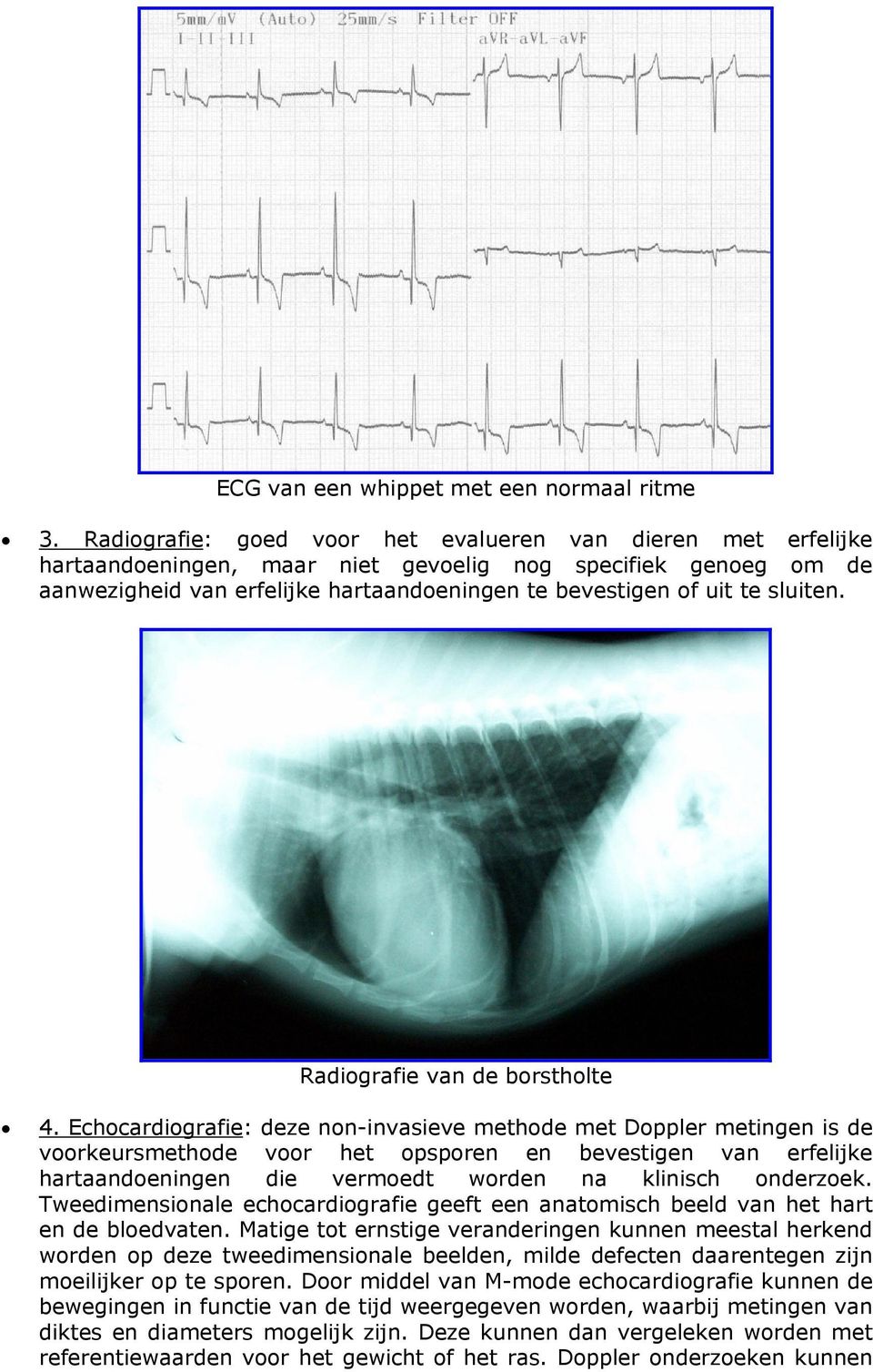 sluiten. Radiografie van de borstholte 4.