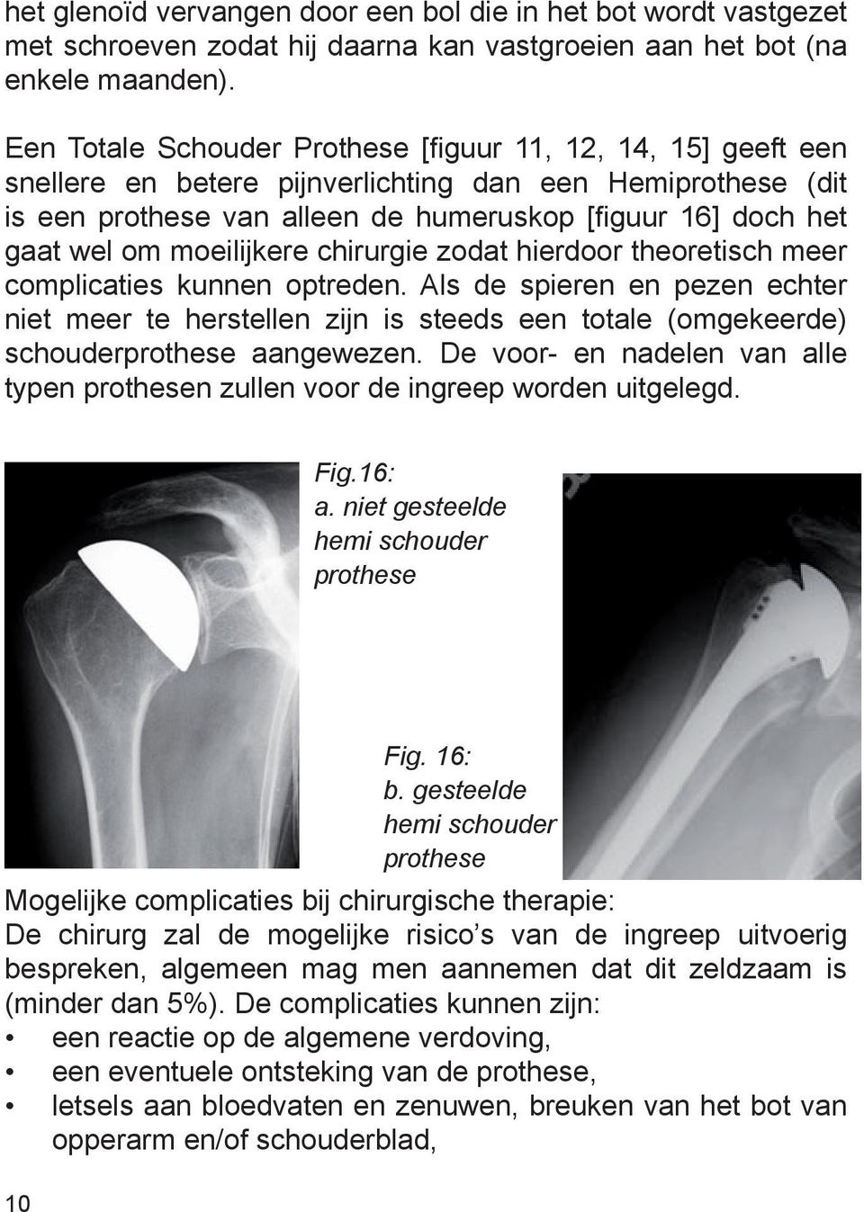 moeilijkere chirurgie zodat hierdoor theoretisch meer complicaties kunnen optreden.