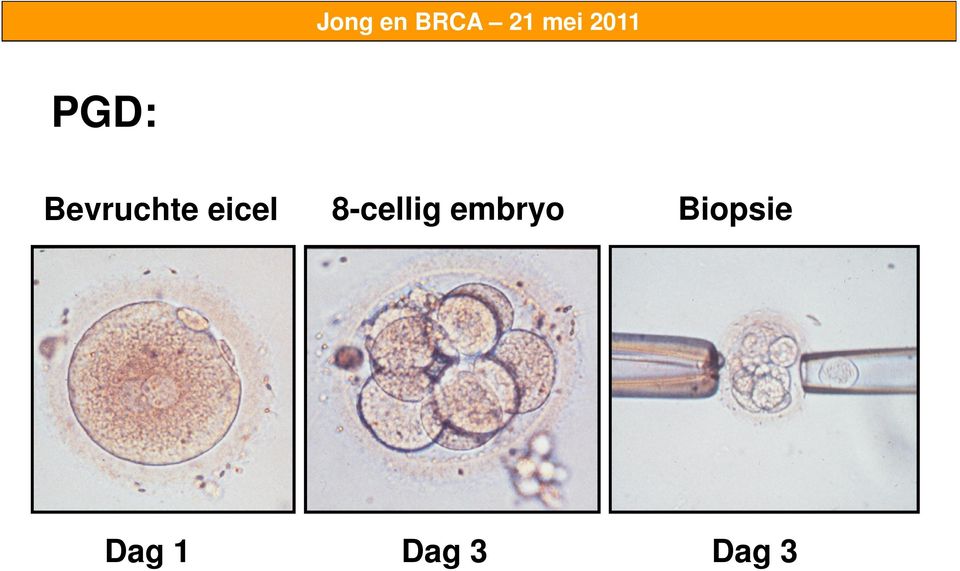 embryo Biopsie