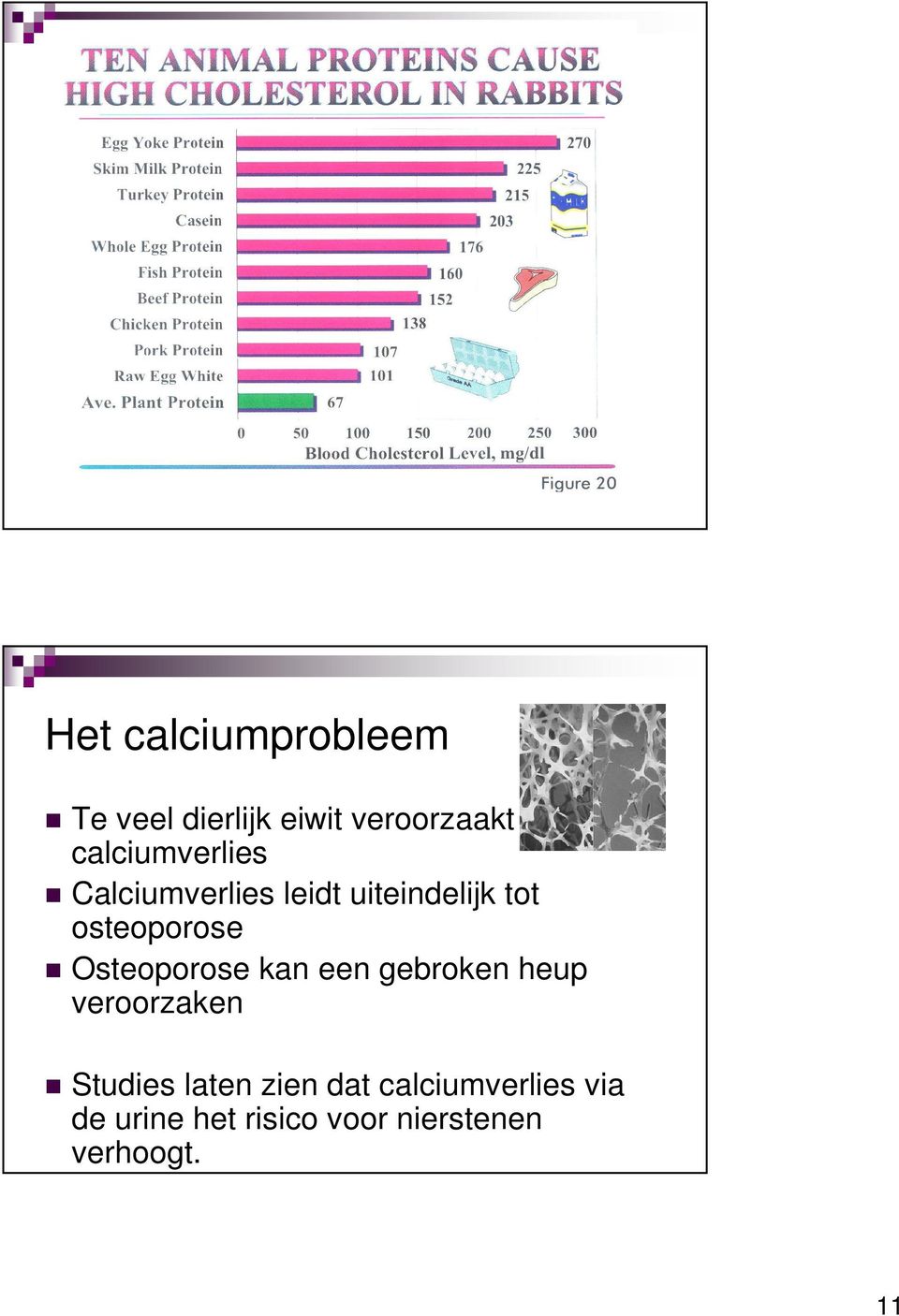 osteoporose Osteoporose kan een gebroken heup veroorzaken