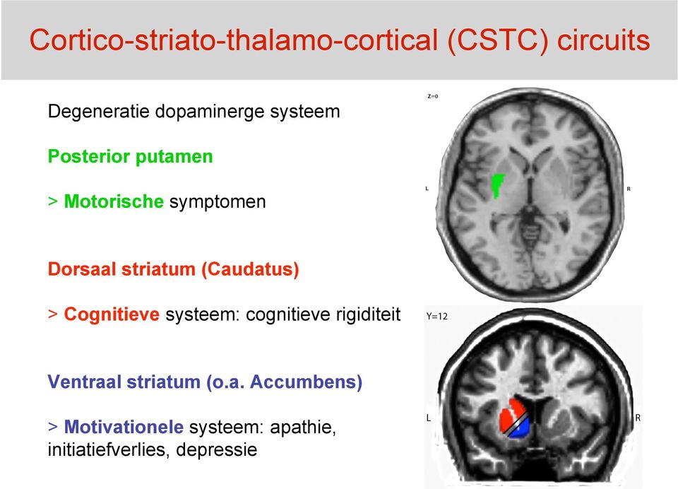 (Caudatus) > Cognitieve systeem: cognitieve rigiditeit Ventraal striatum