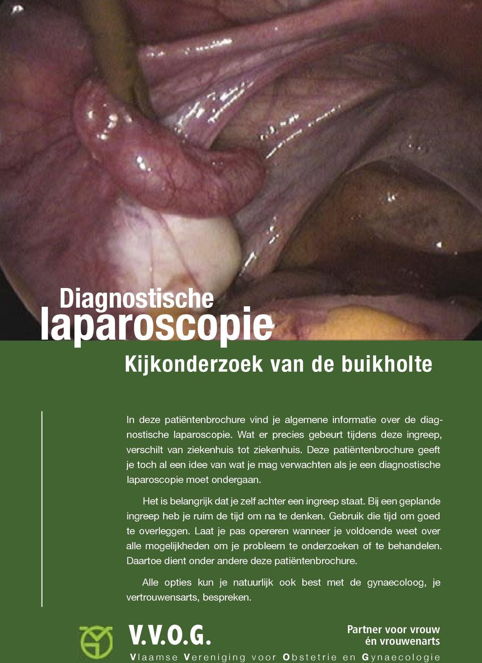 Deze patiëntenbrochure geeft je toch al een idee van wat je mag verwachten als je een diagnostische laparoscopie moet ondergaan. Het is belangrijk dat je zelf achter een ingreep staat.