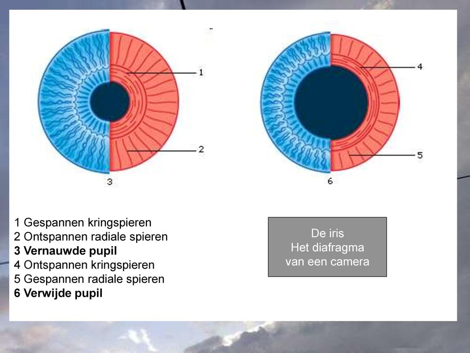 Ontspannen kringspieren 5 Gespannen radiale