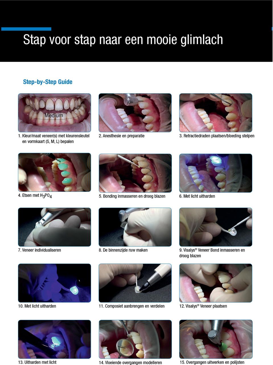 Met licht uitharden 7. Veneer individualiseren 8. De binnenzijde ruw maken 9. Visalys Veneer Bond inmasseren en droog blazen 10.