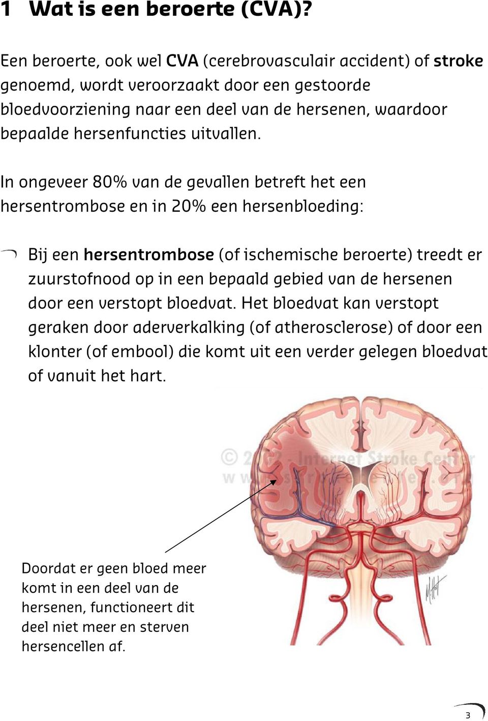 hersenfuncties uitvallen.