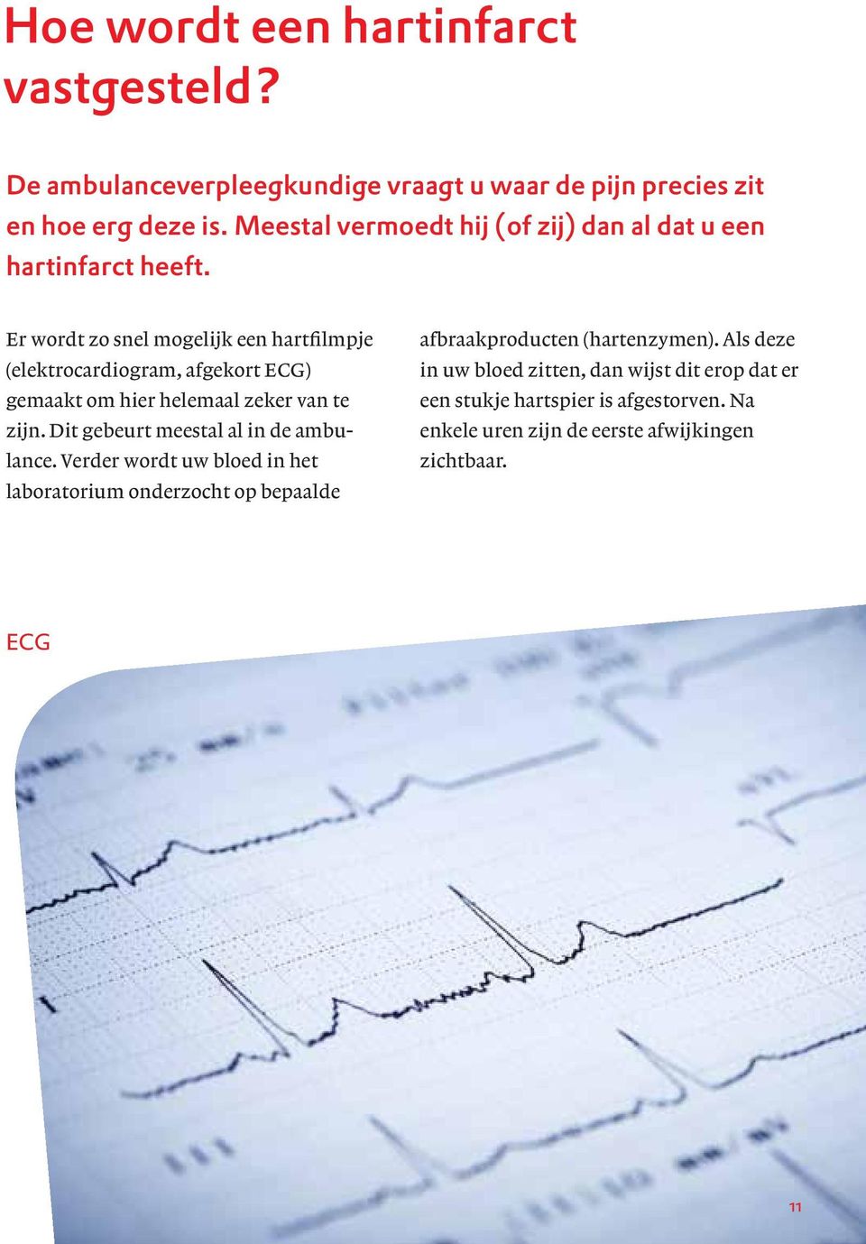 Er wordt zo snel mogelijk een hartfilmpje (elektrocardiogram, afgekort ECG) gemaakt om hier helemaal zeker van te zijn.