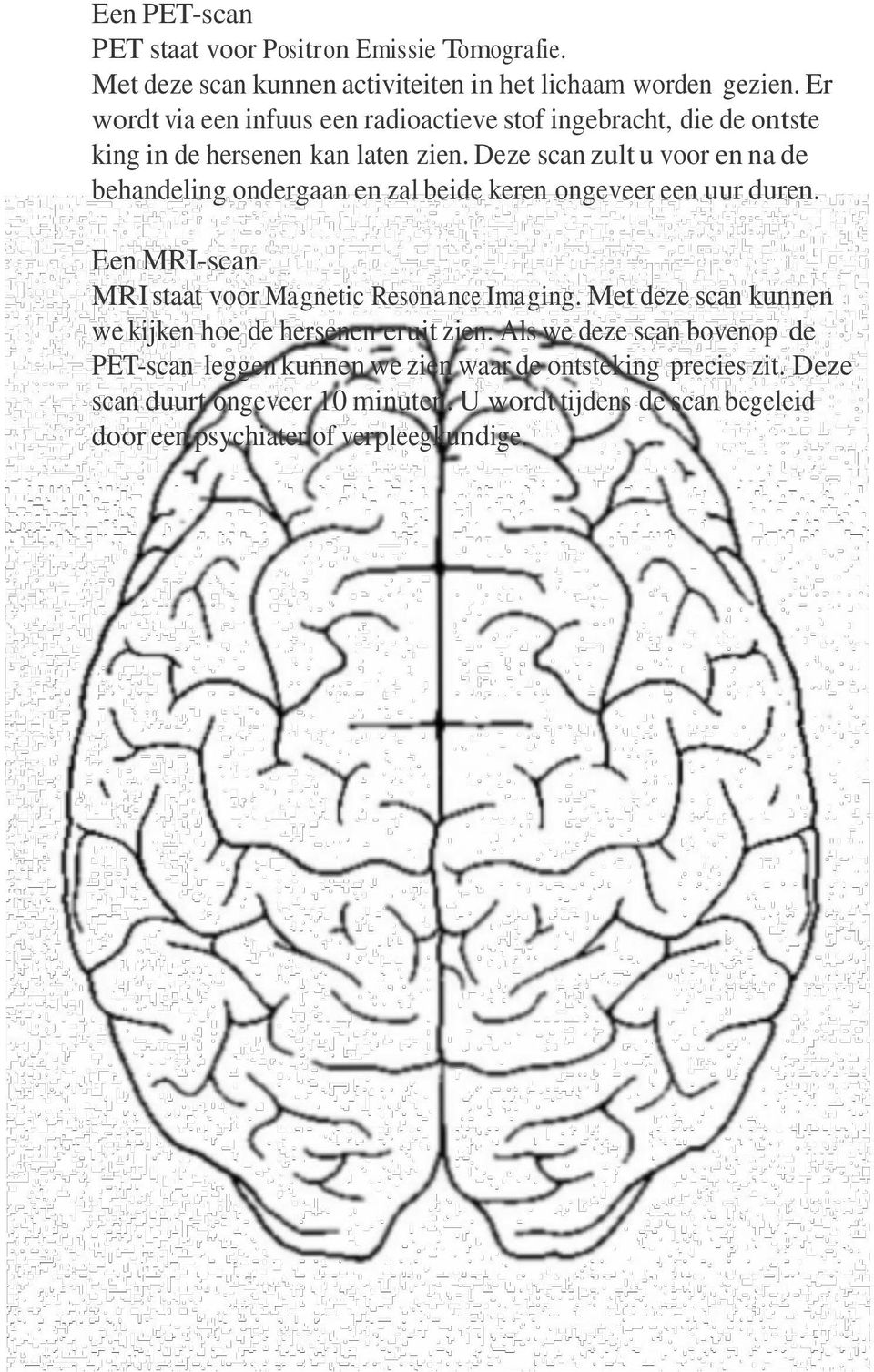 Deze scan zult u voor en na de behandeling ondergaan en zal beide keren ongeveer een uur duren. Een MRI-scan MRI staat voor Magnetic Resonance Imaging.