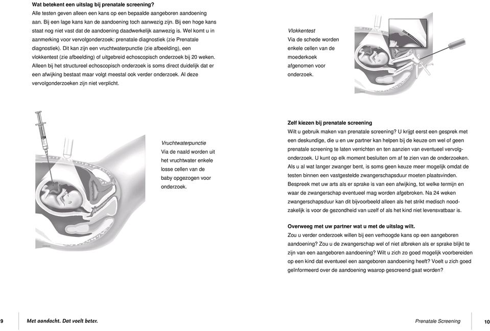 Dit kan zijn een vruchtwaterpunctie (zie afbeelding), een vlokkentest (zie afbeelding) of uitgebreid echoscopisch onderzoek bij 20.