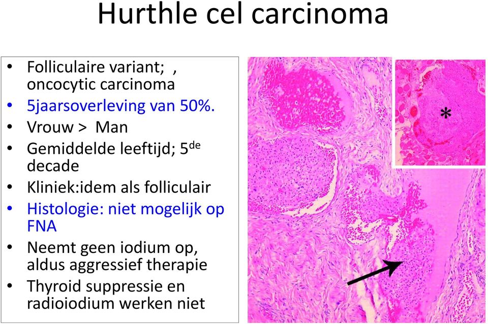 Vrouw > Man Gemiddelde leeftijd; 5 de decade Kliniek:idem als