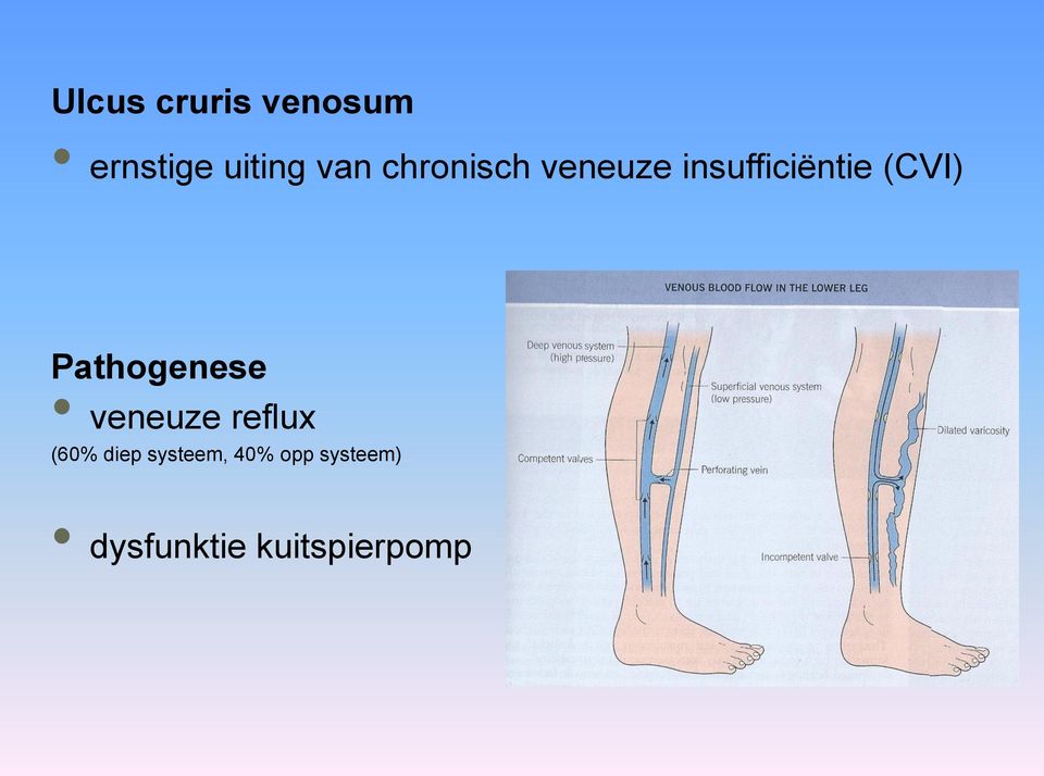 Pathogenese veneuze reflux (60% diep