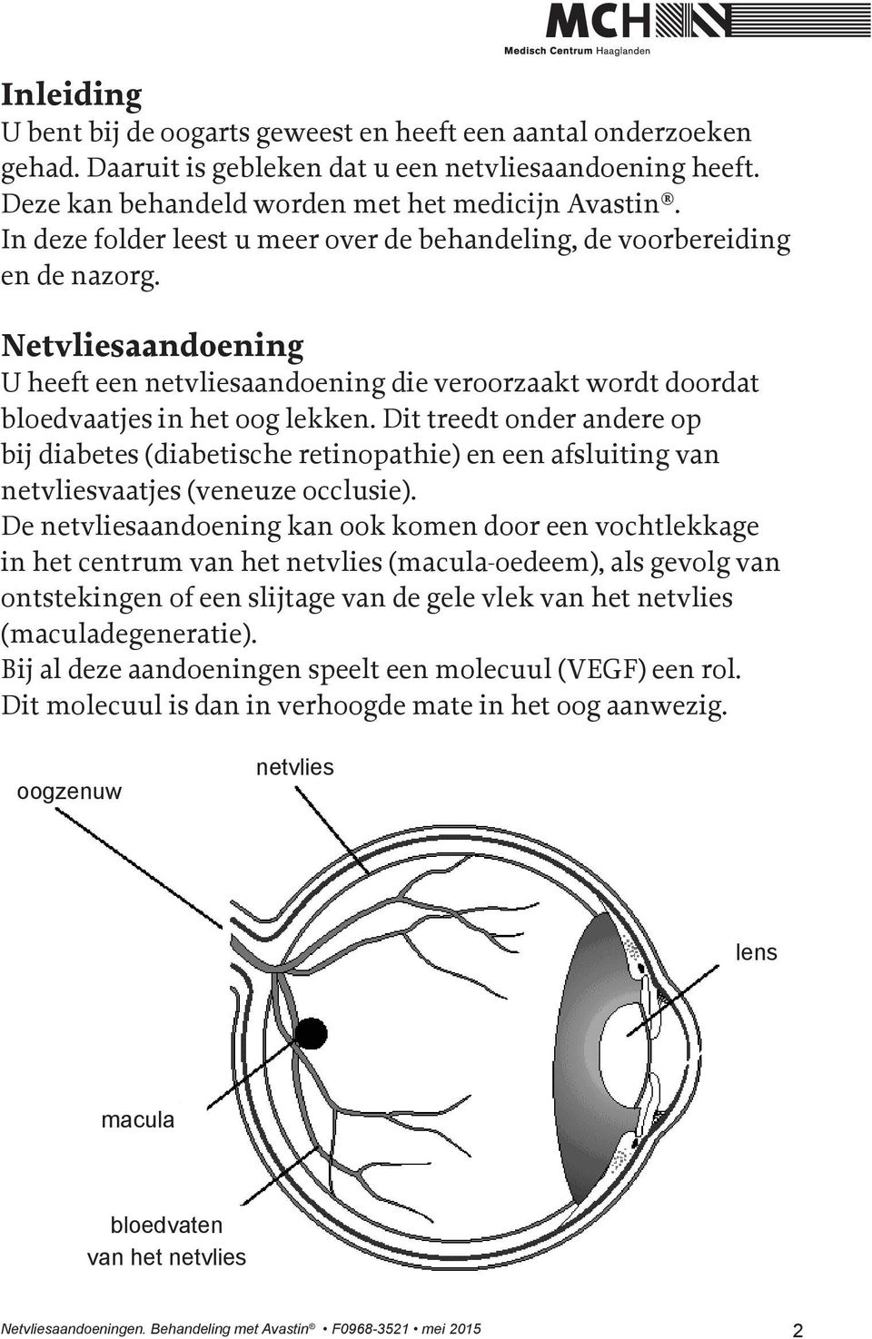 Dit treedt onder andere op bij diabetes (diabetische retinopathie) en een afsluiting van netvliesvaatjes (veneuze occlusie).