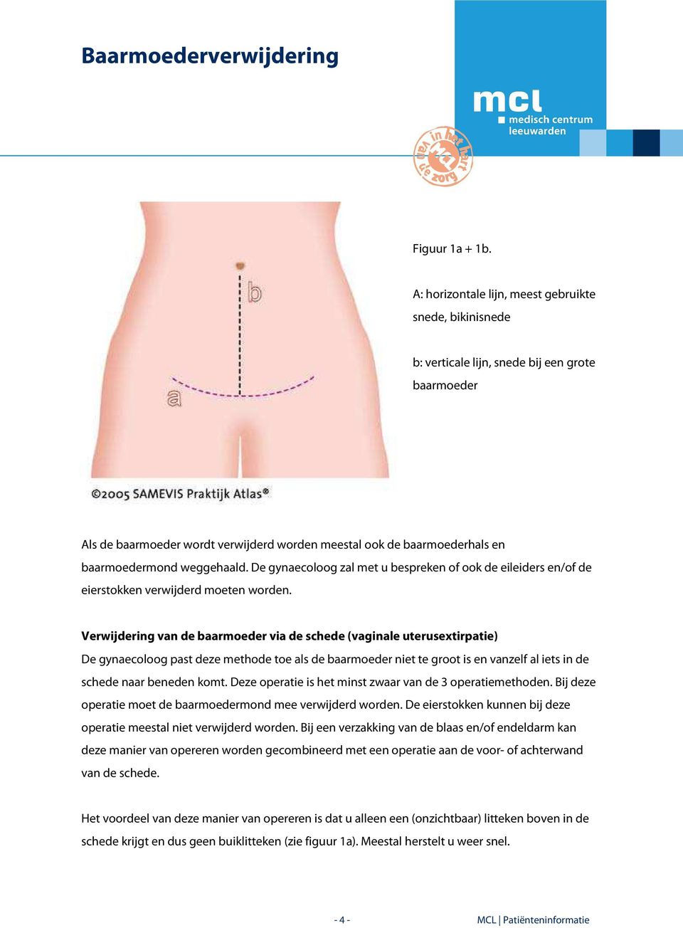 weggehaald. De gynaecoloog zal met u bespreken of ook de eileiders en/of de eierstokken verwijderd moeten worden.