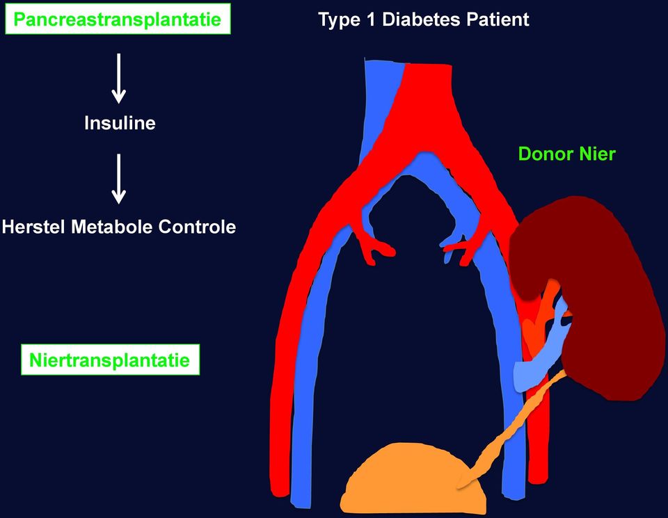 Donor Nier Herstel Metabole