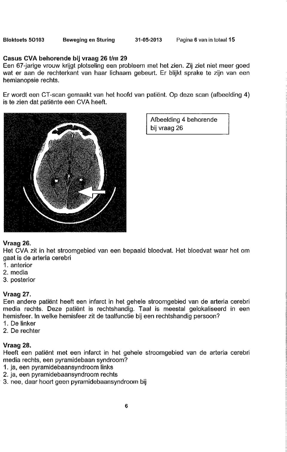 Op deze scan (afbeelding 4) is te zien dat patiënte een CVA heeft. Afbeelding 4 behorende bij vraag 26 Vraag 26. Het CVA zit in het stroomgebied van een bepaald bloedvat.