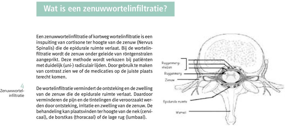 Door gebruik te maken van contrast zien we of de medicaties op de juiste plaats terecht komen.