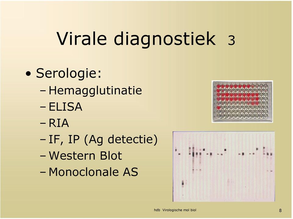 (Ag detectie) Western Blot