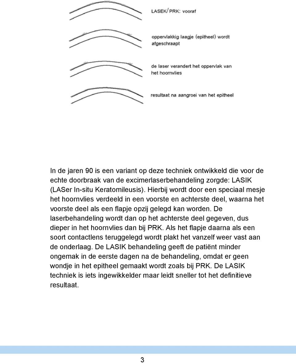 De laserbehandeling wordt dan op het achterste deel gegeven, dus dieper in het hoornvlies dan bij PRK.