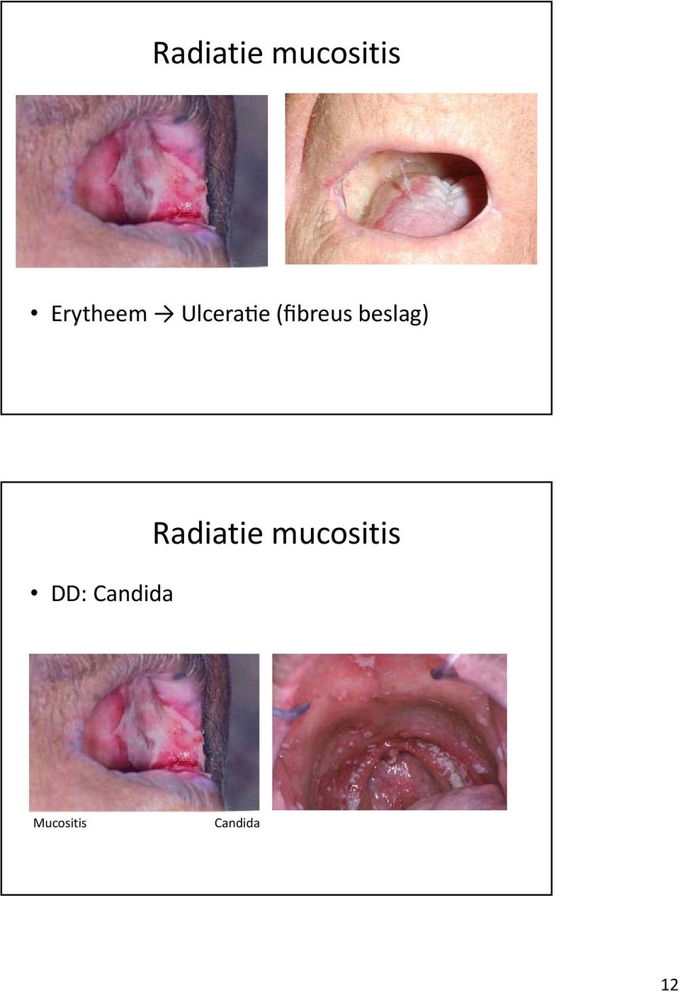 beslag) DD: Candida 