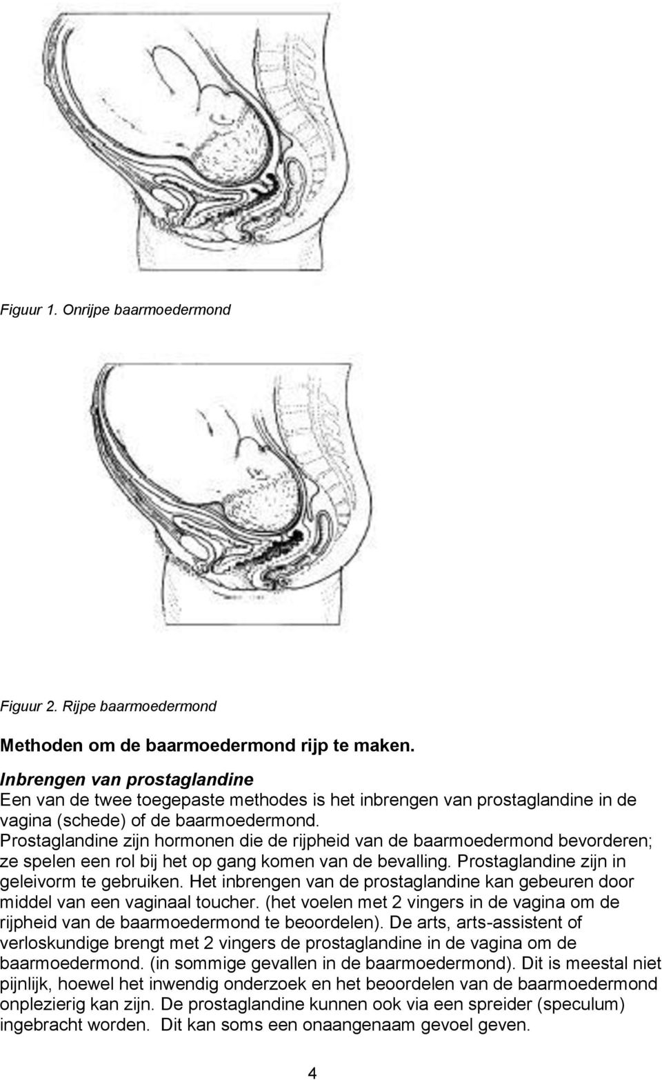 Prostaglandine zijn hormonen die de rijpheid van de baarmoedermond bevorderen; ze spelen een rol bij het op gang komen van de bevalling. Prostaglandine zijn in geleivorm te gebruiken.