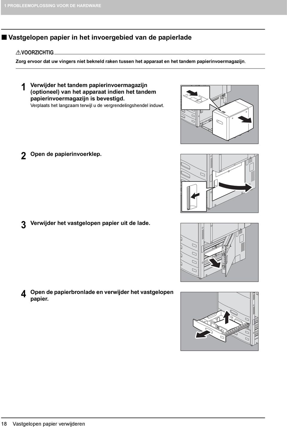 1 Verwijder het tandem papierinvoermagazijn (optioneel) van het apparaat indien het tandem papierinvoermagazijn is bevestigd.