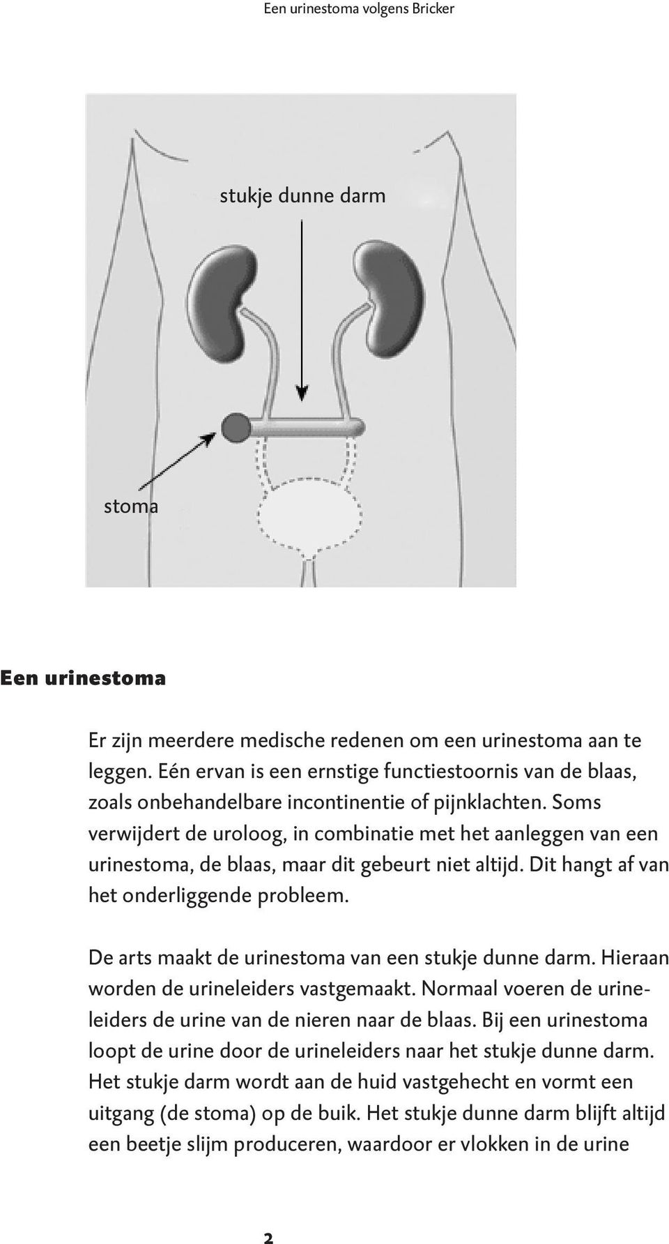 Soms verwijdert de uroloog, in combinatie met het aanleggen van een urinestoma, de blaas, maar dit gebeurt niet altijd. Dit hangt af van het onderliggende probleem.