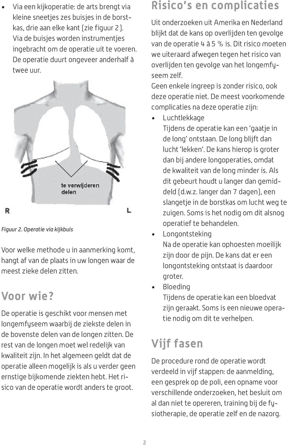 Voor wie? De operatie is geschikt voor mensen met longemfyseem waarbij de ziekste delen in de bovenste delen van de longen zitten. De rest van de longen moet wel redelijk van kwaliteit zijn.