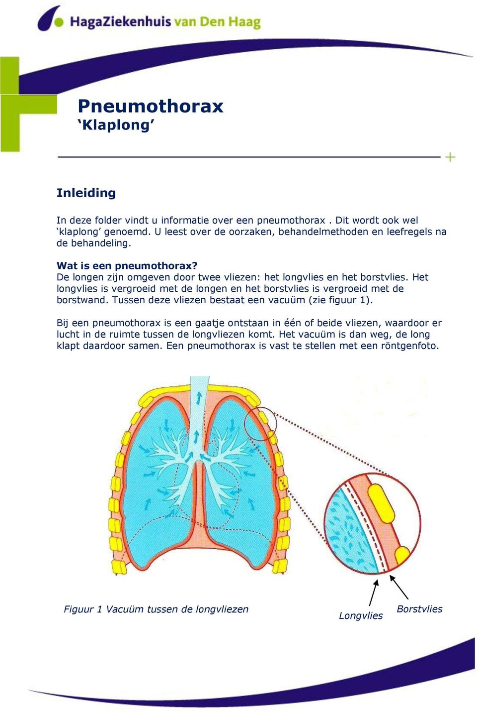 Het longvlies is vergroeid met de longen en het borstvlies is vergroeid met de borstwand. Tussen deze vliezen bestaat een vacuüm (zie figuur 1).