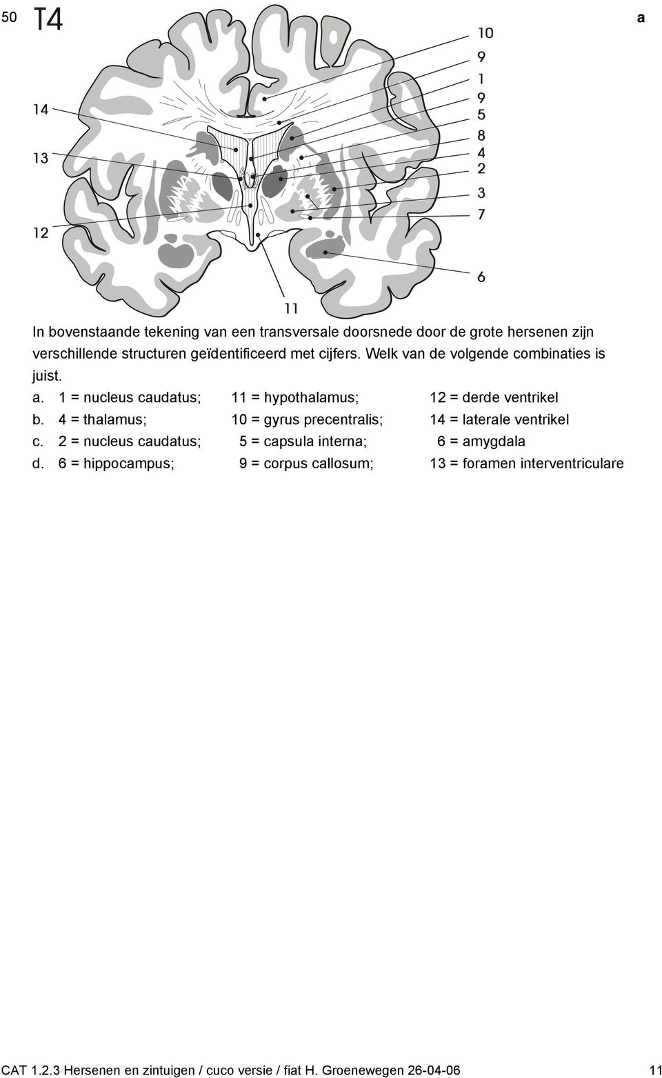 4 = thlmus; 10 = gyrus preentrlis; 14 = lterle ventrikel. 2 = nuleus utus; 5 = psul intern; 6 = mygl.