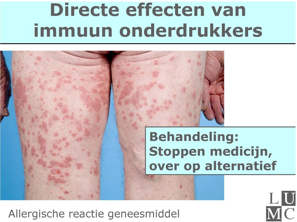 Stoppen medicijn, over op