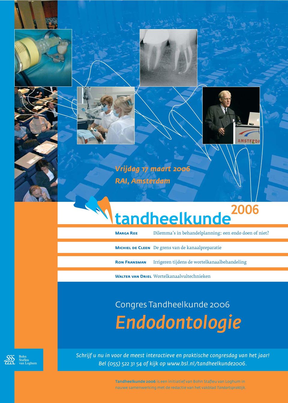 Wortelkanaalvultechnieken Congres Tandheelkunde 2006 Endodontologie Schrijf u nu in voor de meest interactieve en praktische congresdag van het