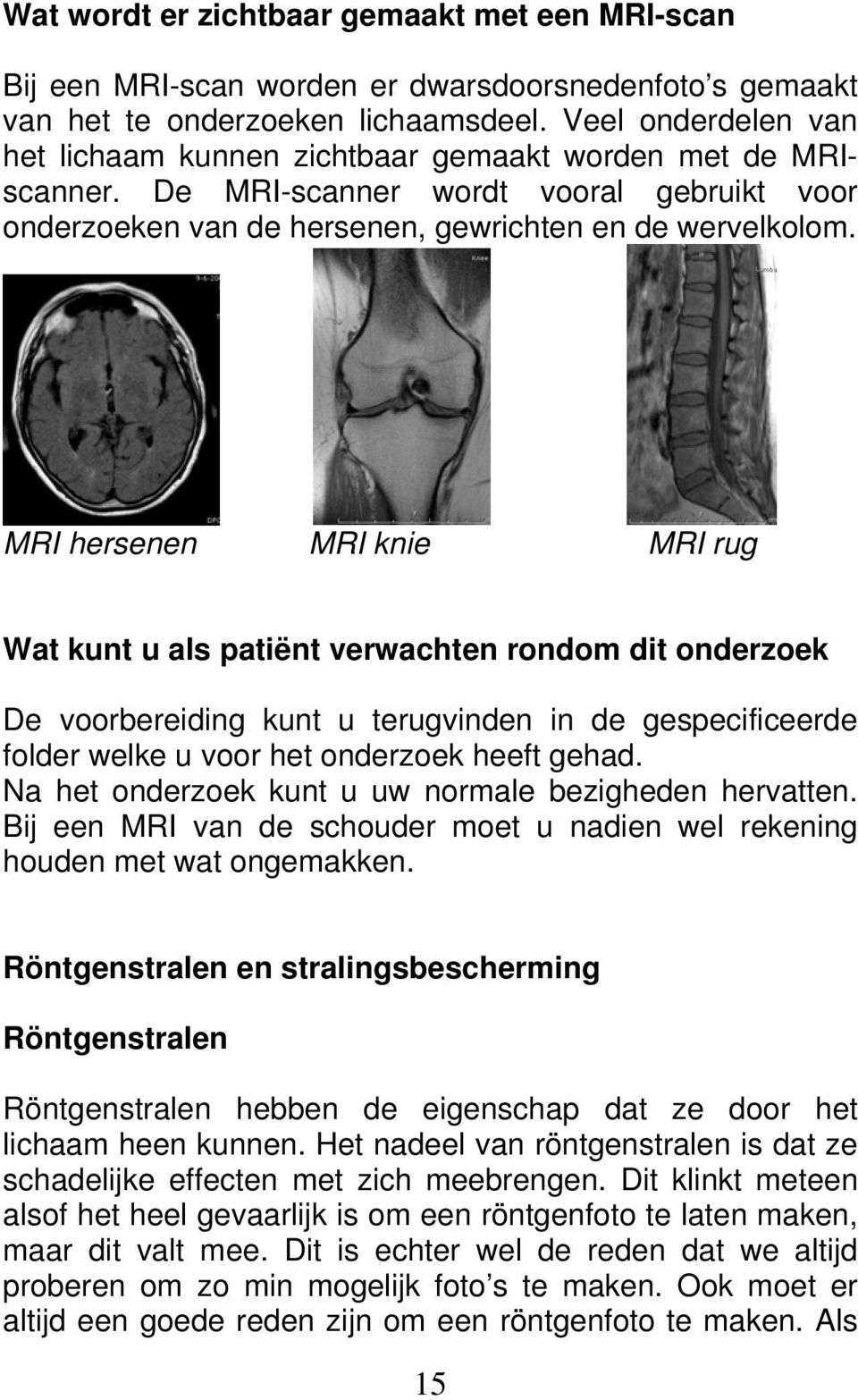 MRI hersenen MRI knie MRI rug Wat kunt u als patiënt verwachten rondom dit onderzoek De voorbereiding kunt u terugvinden in de gespecificeerde folder welke u voor het onderzoek heeft gehad.